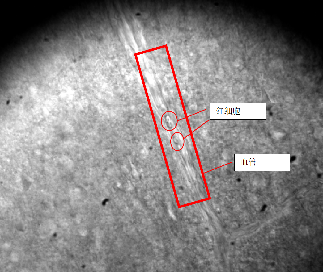 神经元膜片钳实验观测
